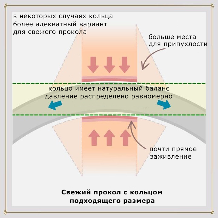 Шишка на ухе: что делать и как себе правильно помочь? - MEDСЕМЬЯ